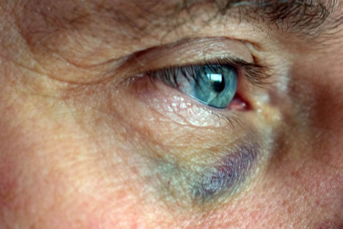 Schweizer Wirtschaft kommt wohl mit einem blauem Auge davon